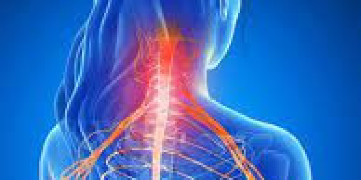 Radicular Pain | Causes and Treatment Options | Genericshub