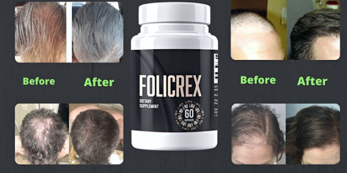 What Is Folicrex Hair Regrowth Supplement: Advantages Of Use? Price In USA, CA, UK, AU & NZ