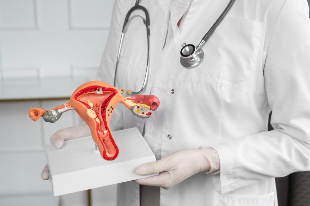 Understanding Polycystic Ovary Syndrome (PCOS) Treatment | by Dr.Sabita Kumari | Jun, 2024 | Medium