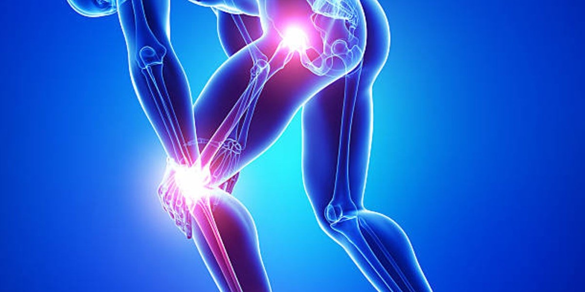 ¿Para qué sirve la cápsula Artralon: alivio del dolor en las articulaciones?