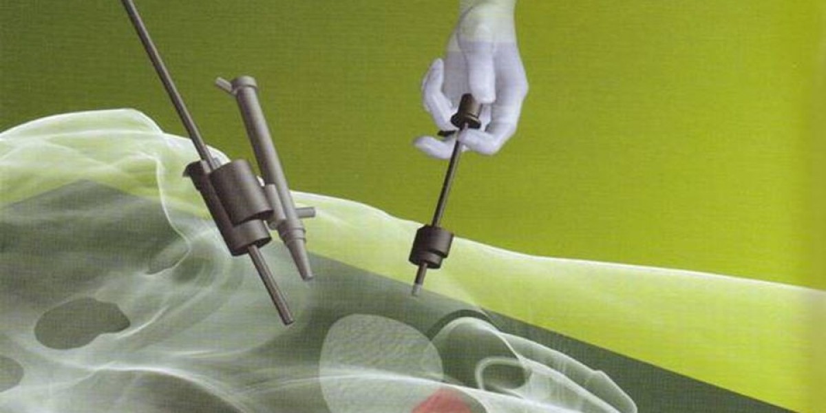 Laparoscopic Electrodes Industry: Evolution of Minimally Invasive Therapies with laparoscopic Electrodes
