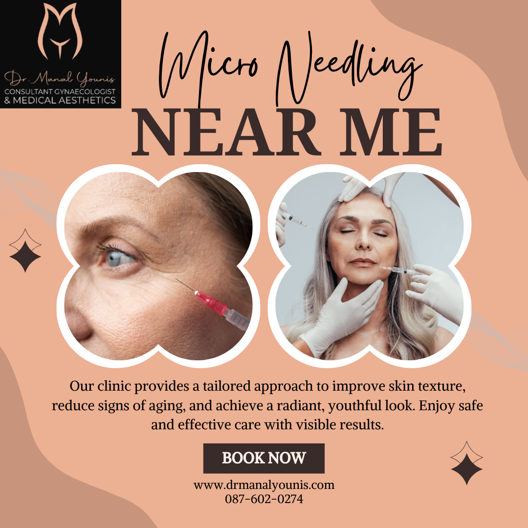 Micro Needling in Clonmel - Social Social Social | Social Social Social