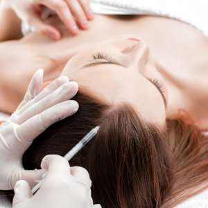 Mesotherapy Hair Regrowth in Montreal | CapillaireMD